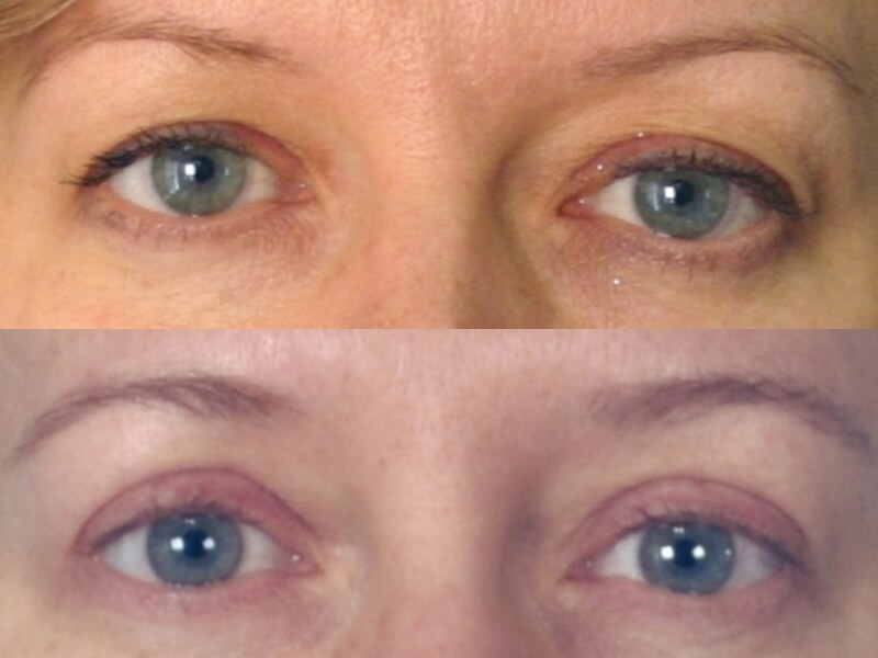 Actual patient results
