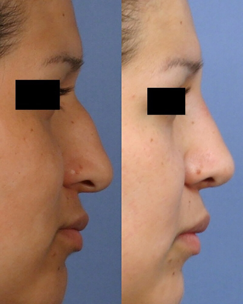 Actual patient results